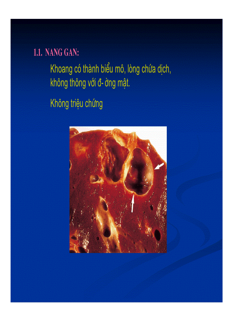 image for page Chẩn đoán hình ảnh gan mật