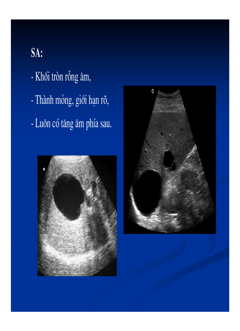image for page Chẩn đoán hình ảnh gan mật