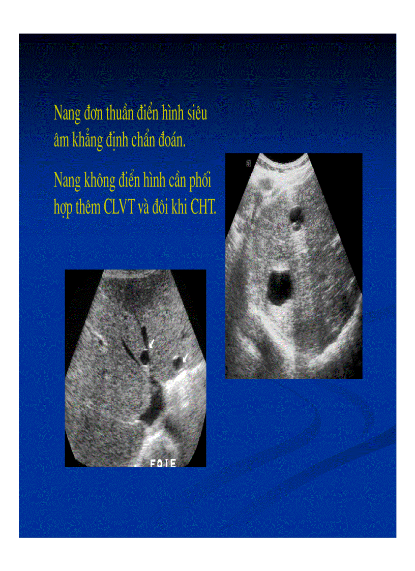 image for page Chẩn đoán hình ảnh gan mật