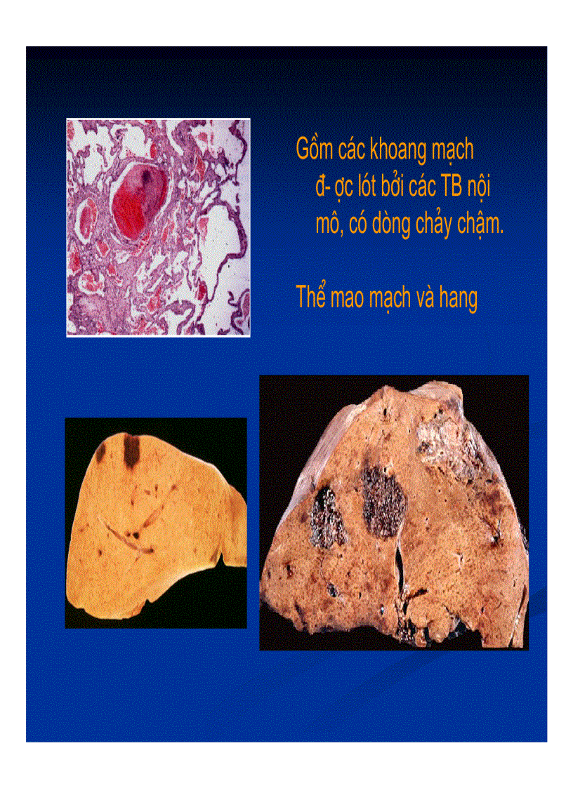 image for page Chẩn đoán hình ảnh gan mật