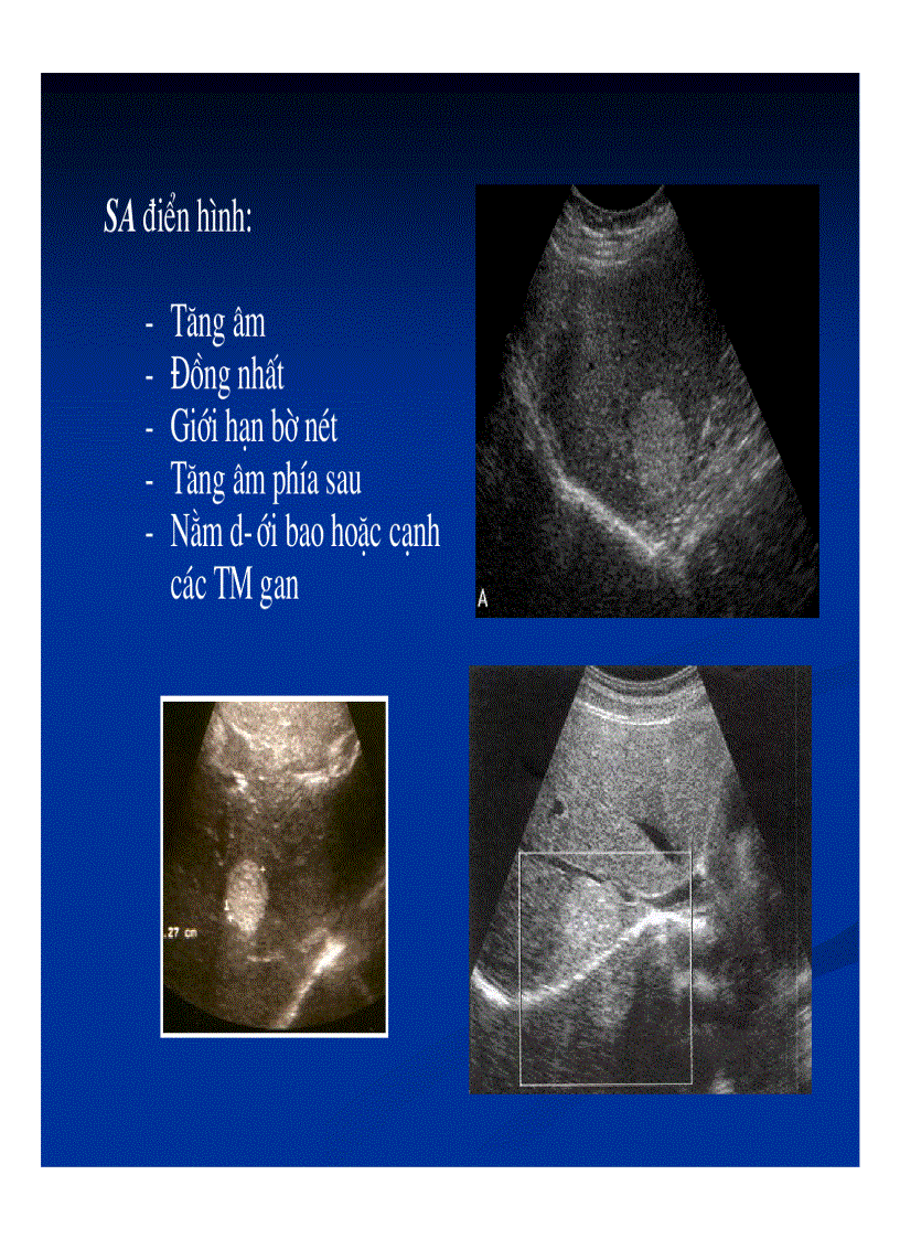 image for page Chẩn đoán hình ảnh gan mật