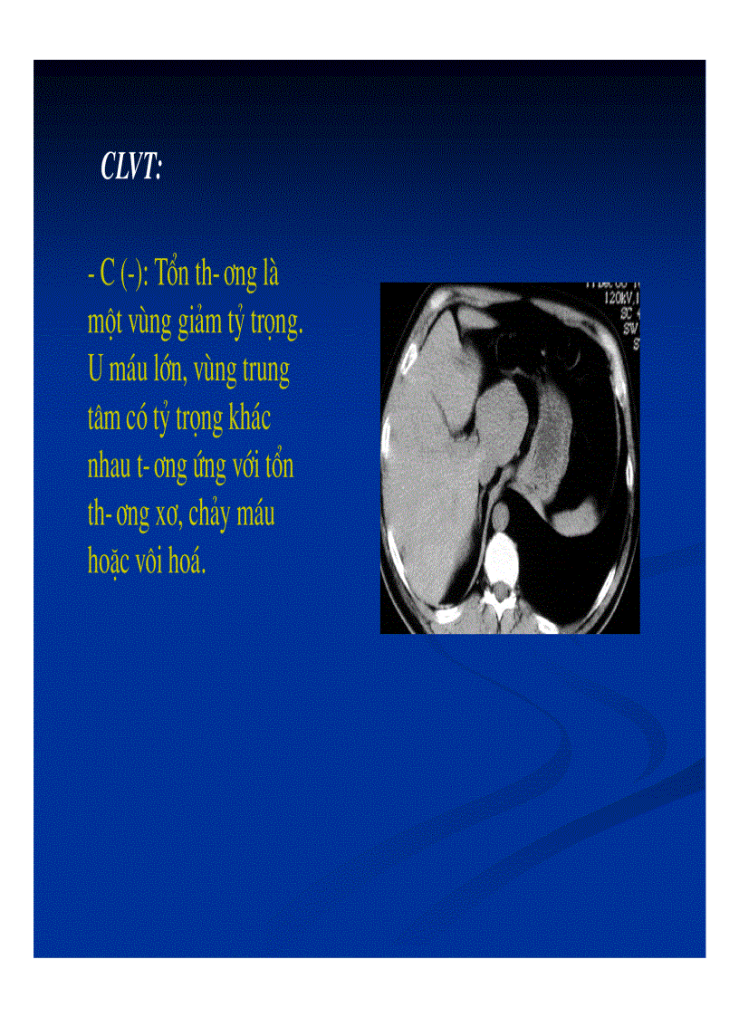 image for page Chẩn đoán hình ảnh gan mật