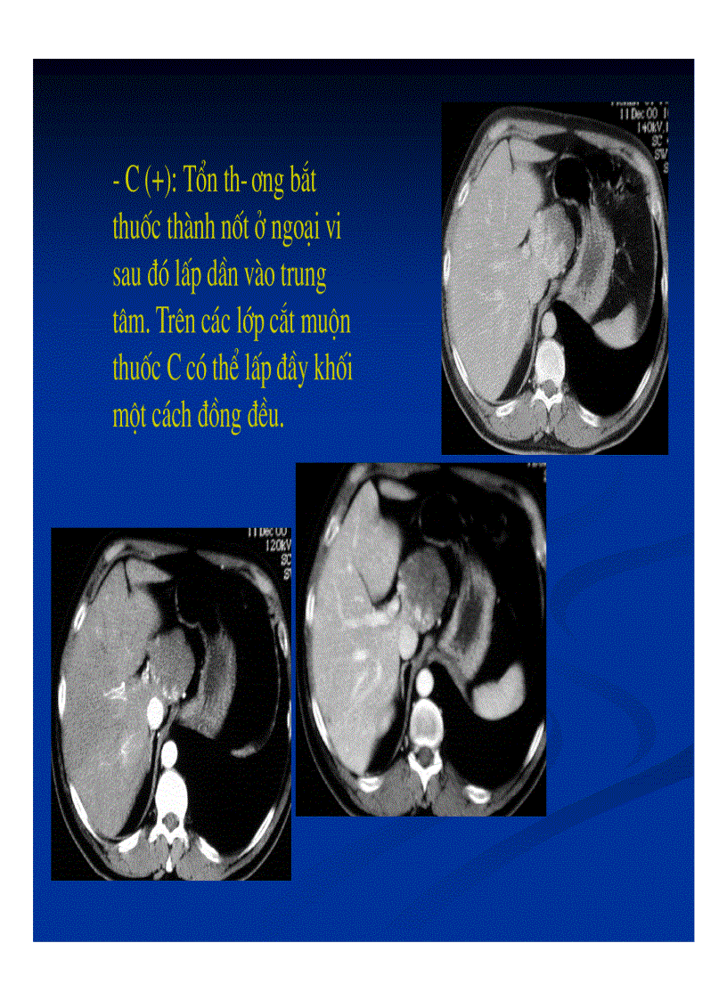 image for page Chẩn đoán hình ảnh gan mật