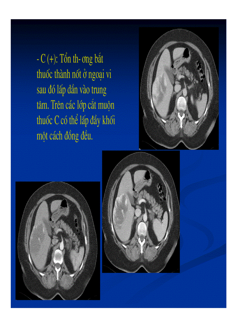 image for page Chẩn đoán hình ảnh gan mật