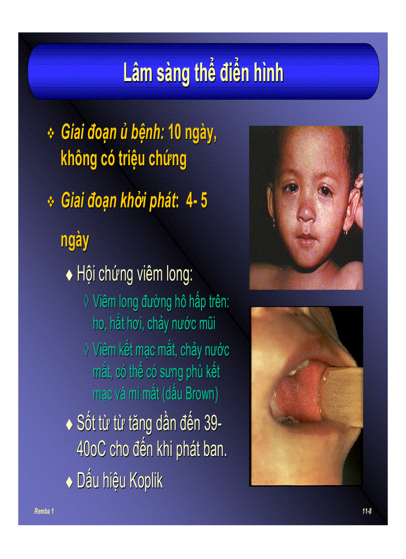 image for page Bệnh sởi