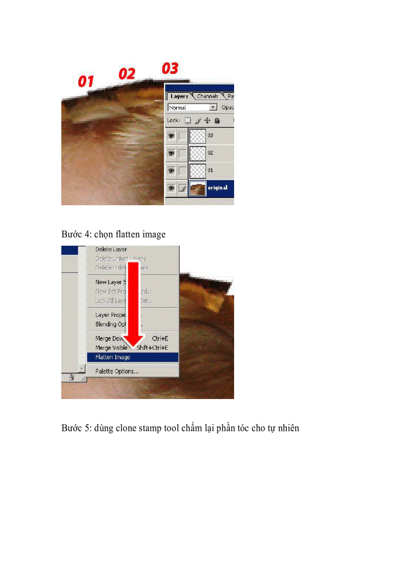 image for page Sửa phần tóc bị mất