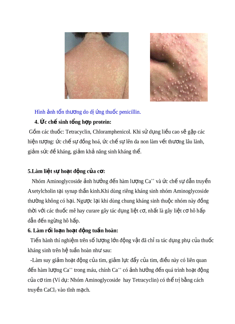 image for page Phối hợp thuốc kháng sinh