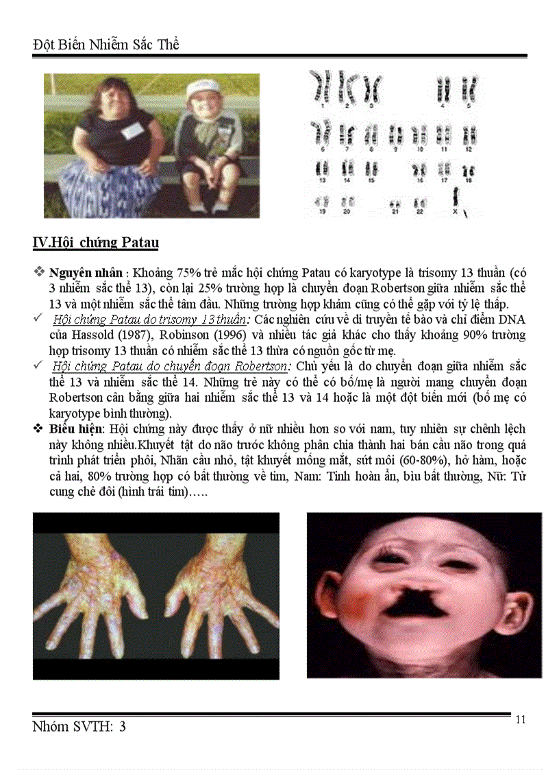 image for page Đột biến nhiễm sắc thể