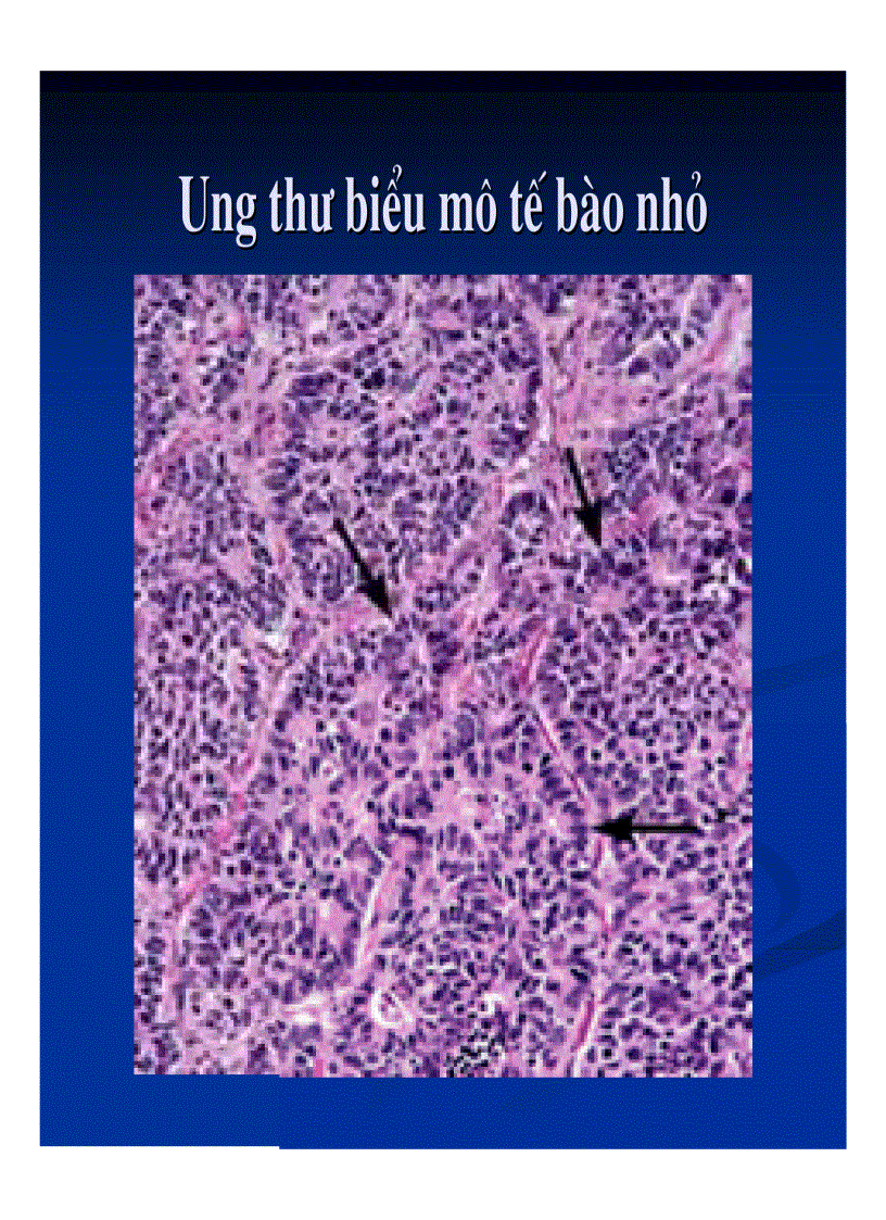 image for page Giải phẩu bệnh ung thư phổi và ung thư thận