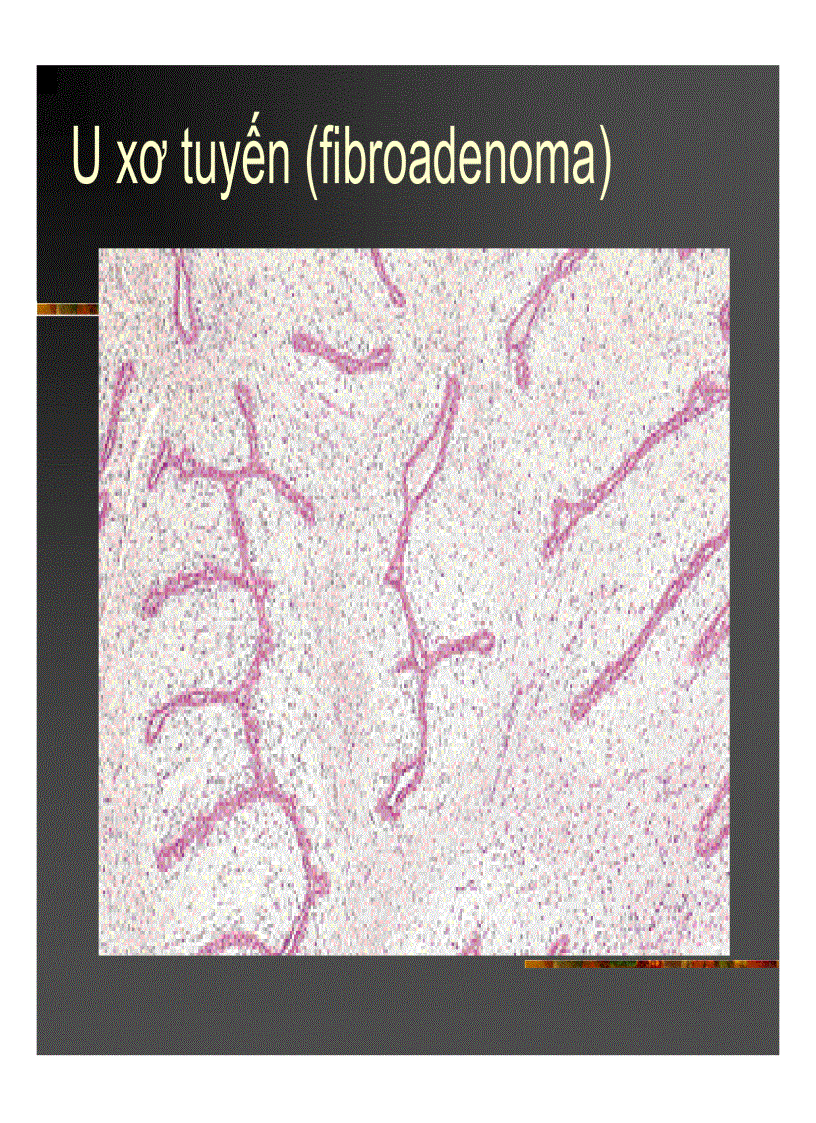 image for page GIẢI PHẪU Bệnh tuyến vú