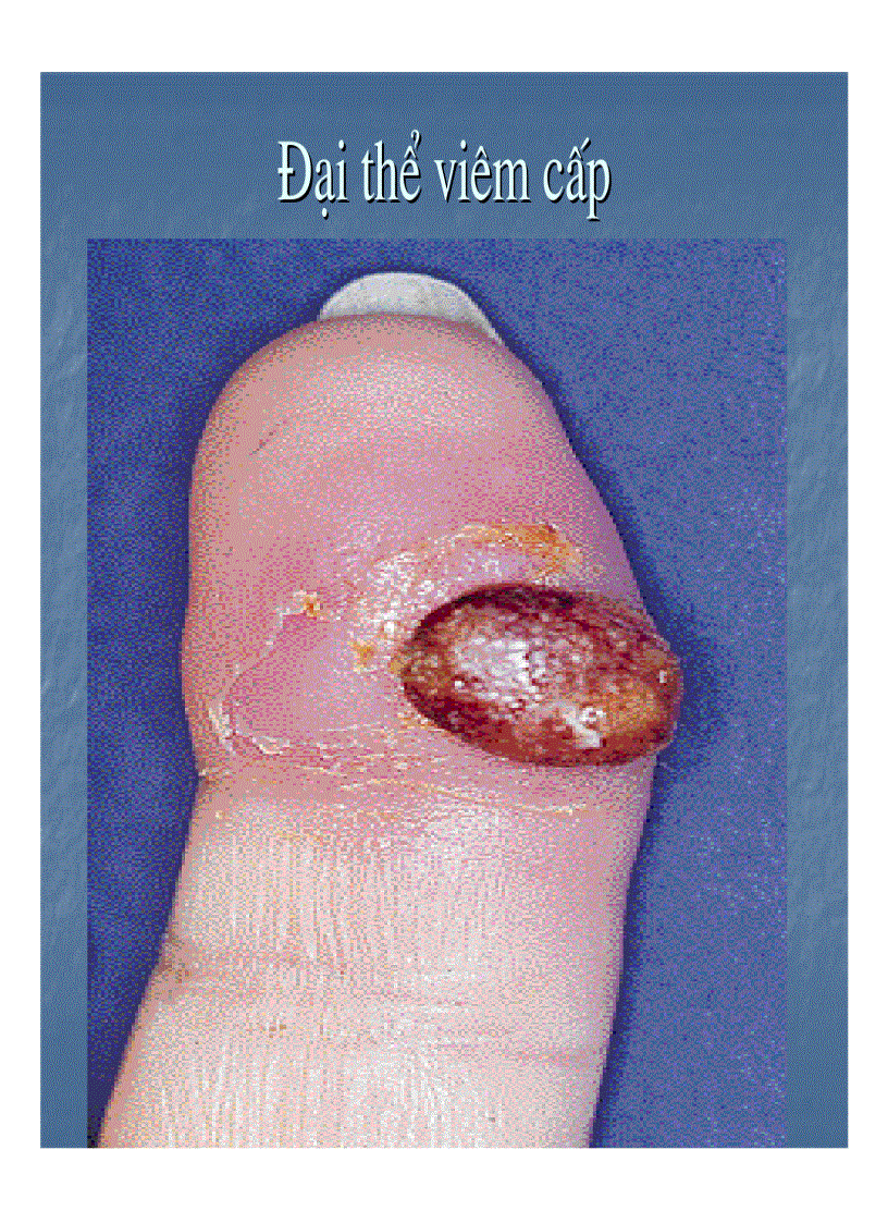 image for page Giải phẫu bệnh viêm 1