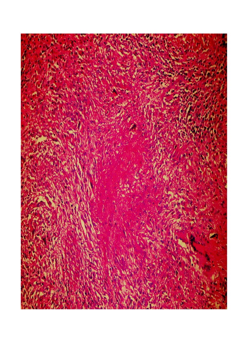 image for page Giải phẫu bệnh viêm 2