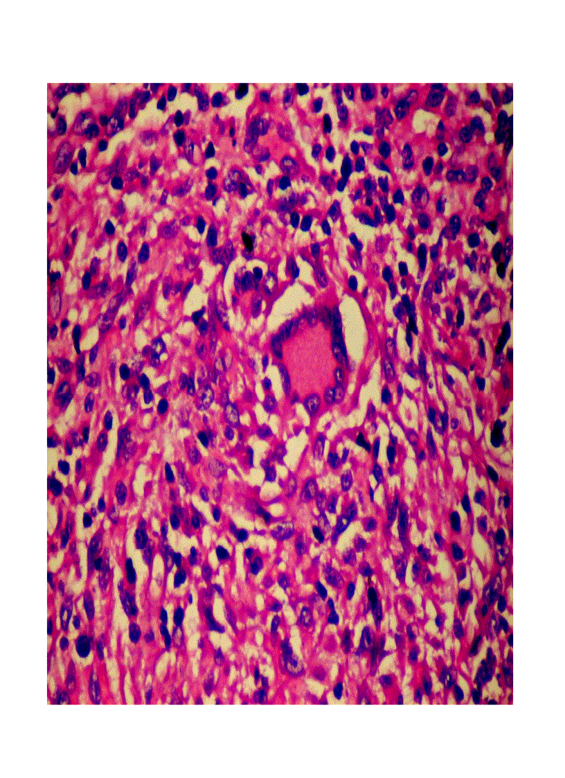 image for page Giải phẫu bệnh viêm 2