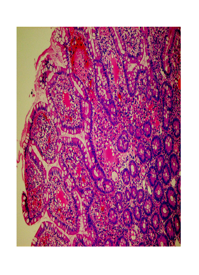 image for page Giải phẫu bệnh viêm 2