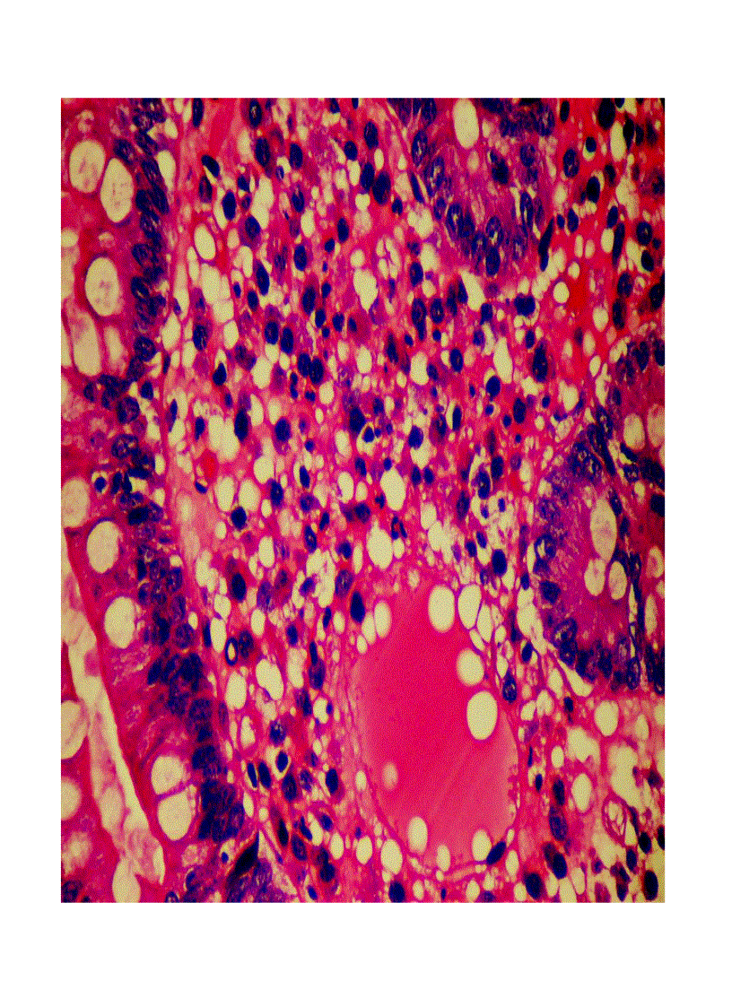 image for page Giải phẫu bệnh viêm 2