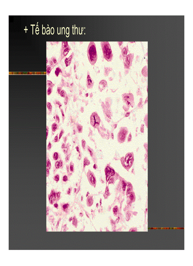 image for page Giải phẫu bệnh Ung thư