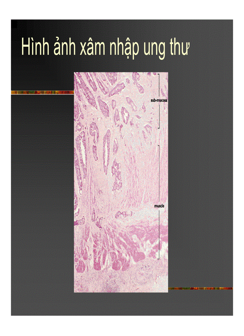 image for page Giải phẫu bệnh Ung thư