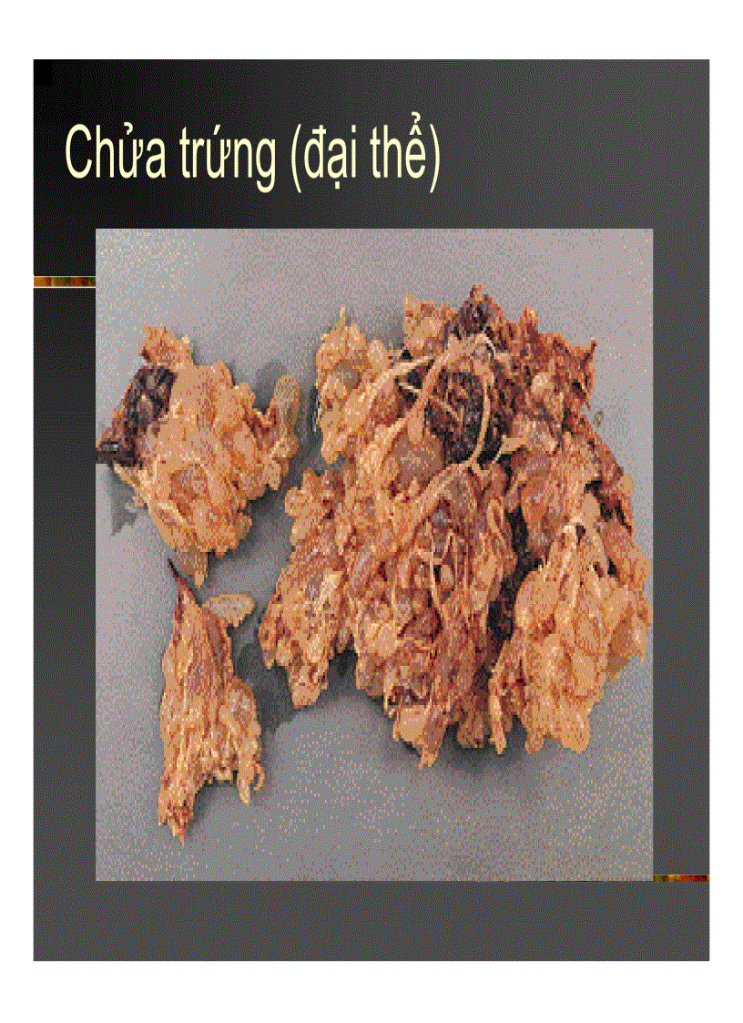 image for page Giải phẫu bệnh Chửa trứng Ung thư biểu mô rau