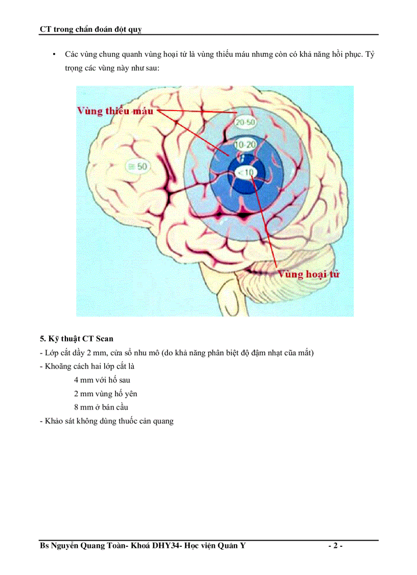 image for page Ct trong chẩn đoán đột quỵ não