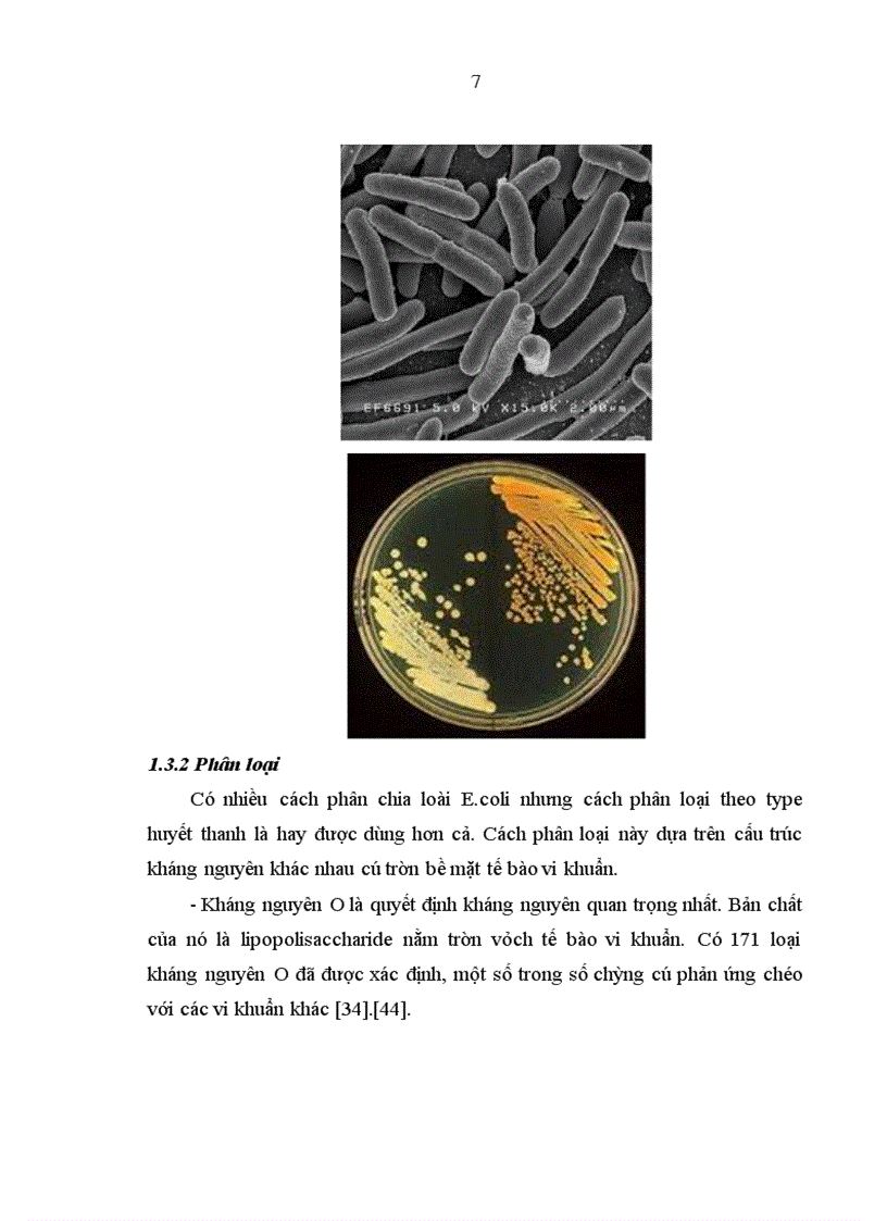 image for page Thiết kế và biểu hiện protein tiểu đơn vị B độc tố không chịu nhiệt LT của ETEC trên quy mô phòng thí nghiệm