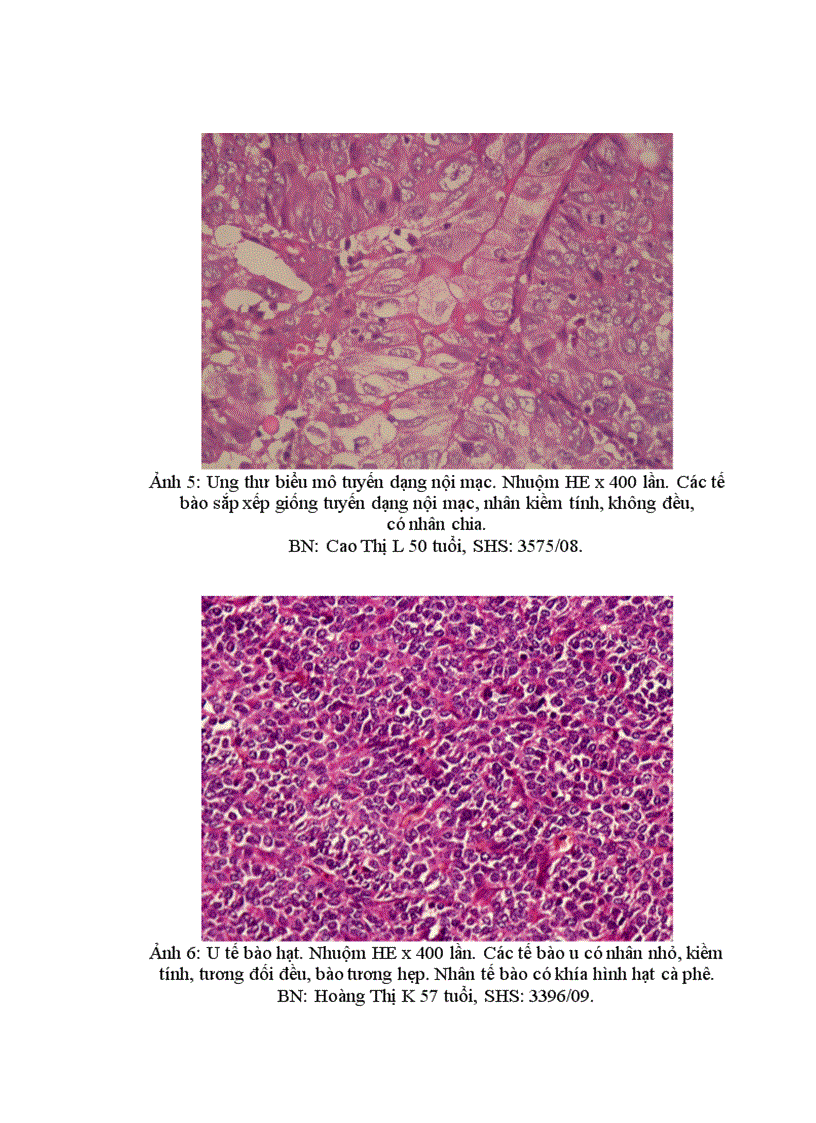 image for page Nhận xét đặc điểm lâm sàng cận lâm sàng và giá trị sinh thiết tức thì trong chẩn đoán u buồng trứng tại Bệnh viện K