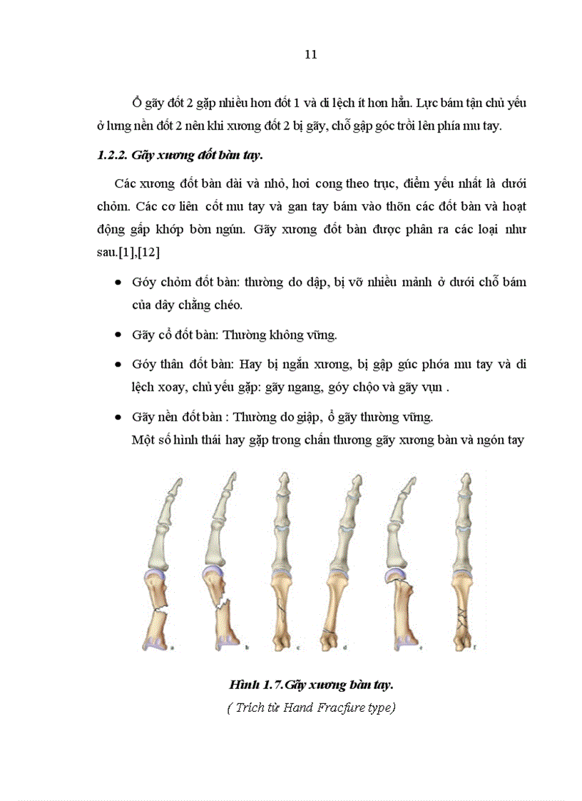 image for page Đánh giá kết quả phẫu thuật gãy xương bàn tay ngón tay bằng nẹp vít