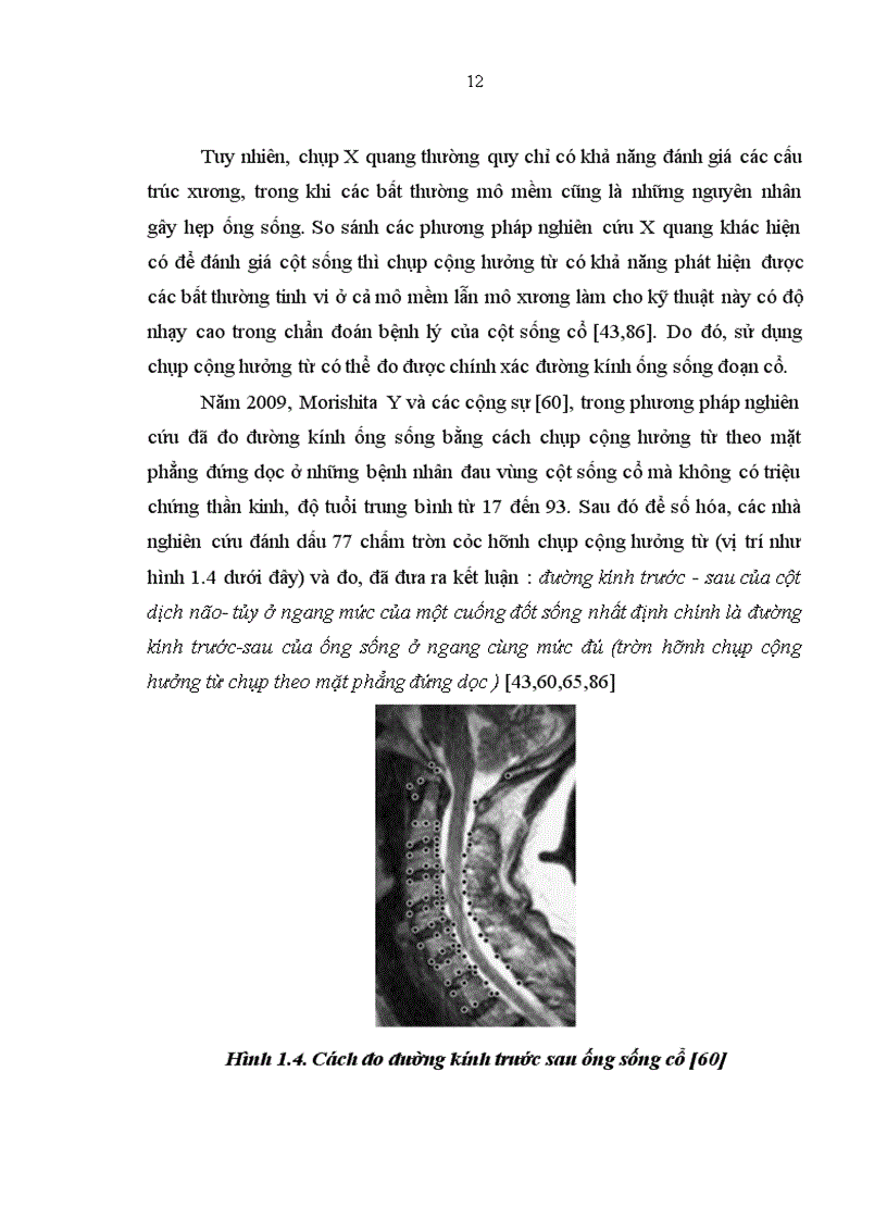 image for page Nghiên cứu các đặc điểm lâm sàng và hình ảnh chụp cộng hưởng từ của bệnh nhân hẹp ống sống cổ tại Khoa Thần kinh Bệnh viện Bạch Mai 1