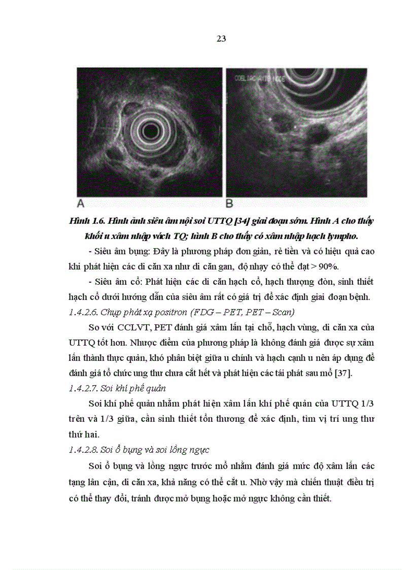 image for page Nghiên cứu đặc điểm lâm sàng và mô bệnh học ung thư biểu mô thực quản 1
