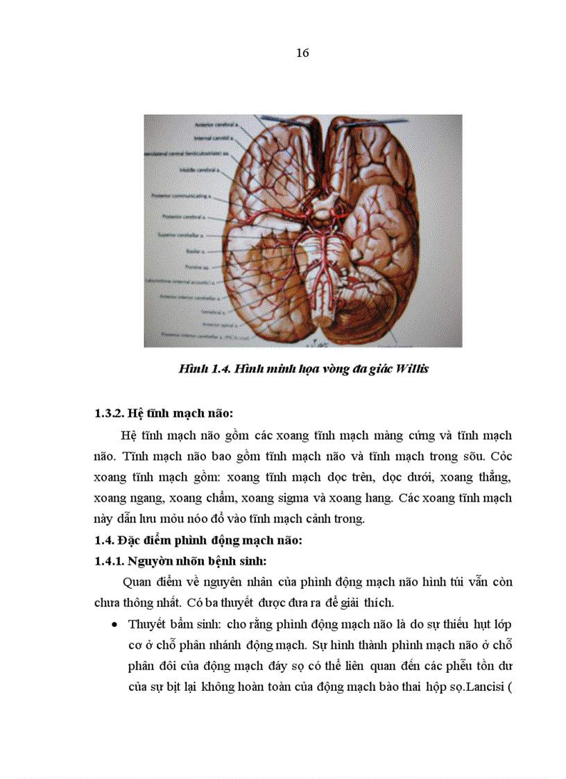 image for page Nghiên cứu đặc điểm lâm sàng và hình ảnh học của bệnh nhân xuất huyết dưới nhện do vỡ phình động mạch thông trước tại khoa thần kinh bệnh viện Bạch Mai 1
