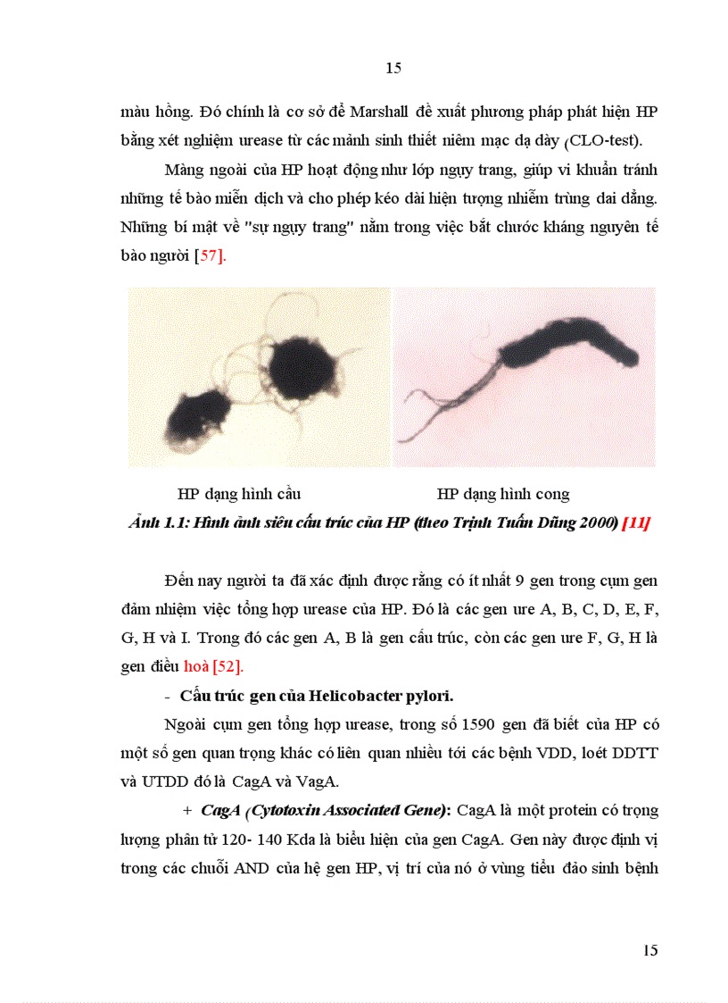 image for page Nghiên cứu đặc điểm lâm sàng nội soi mô bệnh học nhiễm các týp Helicobacter pylori trong viêm teo niêm mạc dạ dày