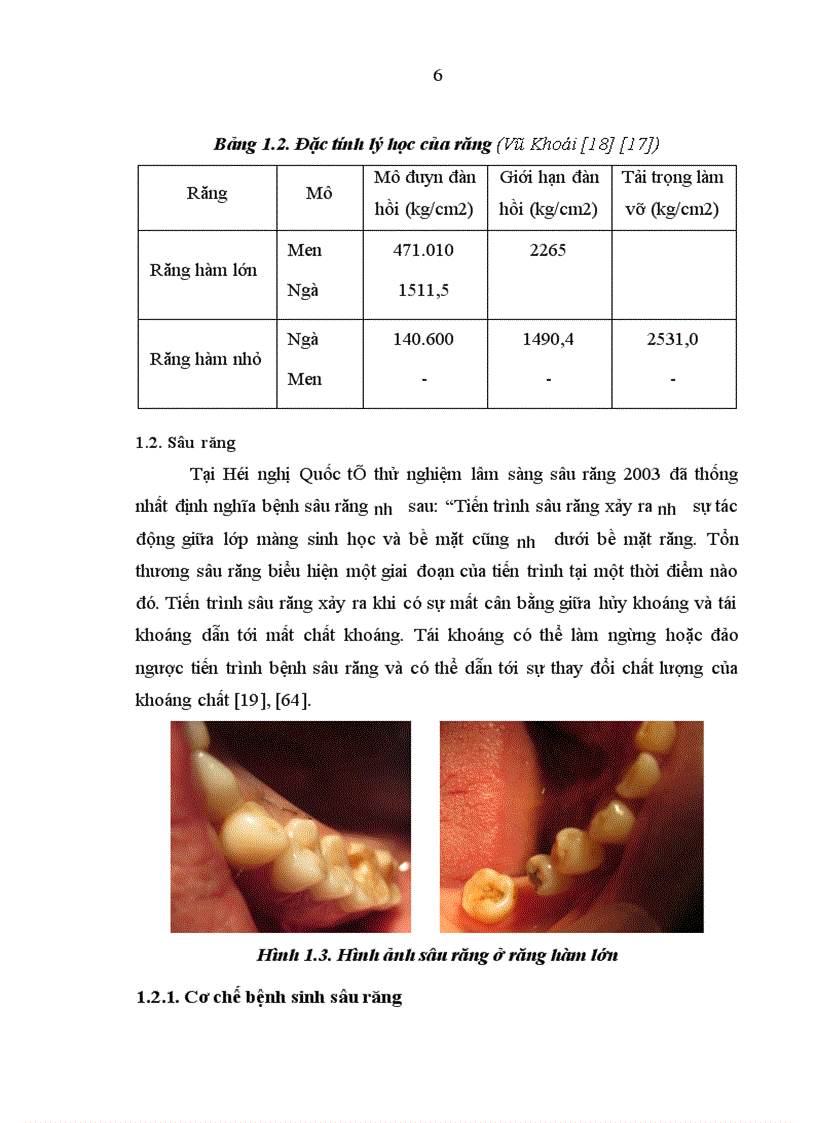 Đánh giá kết quả phục hồi tổn thương thân răng bằng Inlay sứ E maxpress cho nhóm răng sau