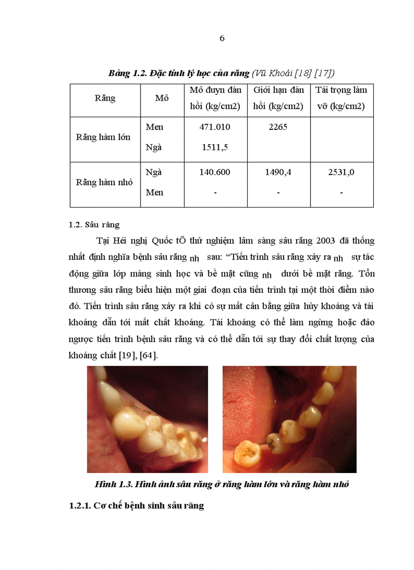 Đánh giá kết quả phục hồi tổn thương thân răng bằng Inlay sứ E maxpress cho nhóm răng sau 1