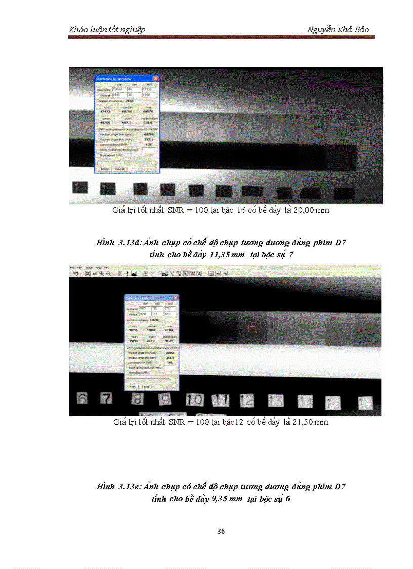 image for page Tìm hiểu cấu tạo và xác định chế độ chiếu chụp hệ ghi nhận ảnh chụp bức xạ bằng công nghệ huỳnh quang kỹ thuật số Digital Fluoroscopy Radiography
