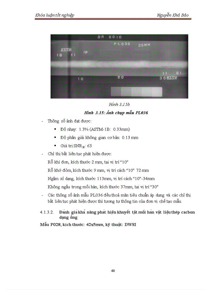 image for page Tìm hiểu cấu tạo và xác định chế độ chiếu chụp hệ ghi nhận ảnh chụp bức xạ bằng công nghệ huỳnh quang kỹ thuật số Digital Fluoroscopy Radiography