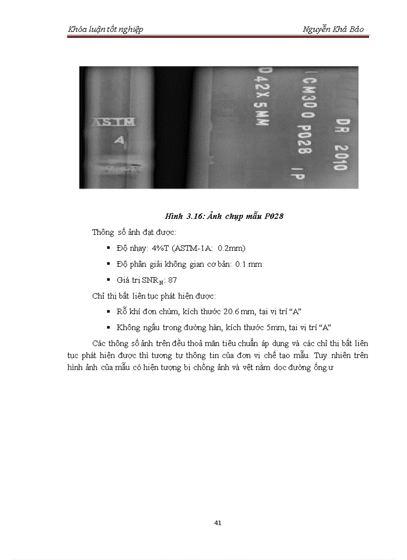 image for page Tìm hiểu cấu tạo và xác định chế độ chiếu chụp hệ ghi nhận ảnh chụp bức xạ bằng công nghệ huỳnh quang kỹ thuật số Digital Fluoroscopy Radiography