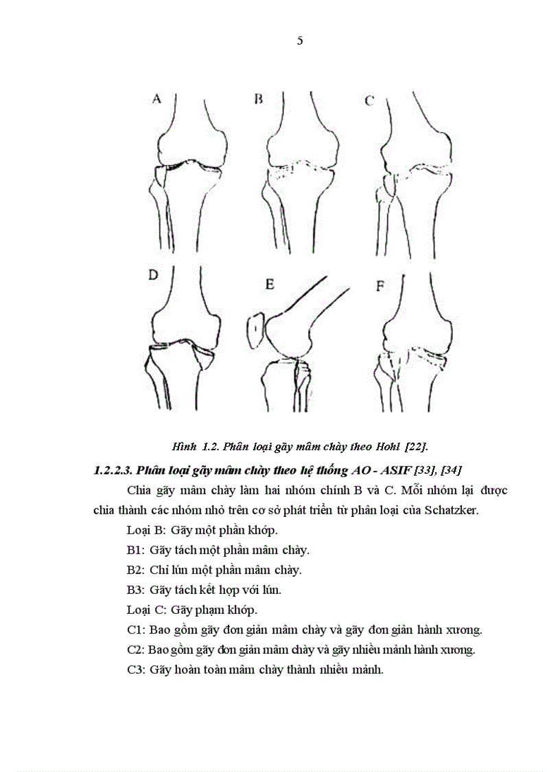 image for page Nghiên cứu sự thay đổi áp lực khoang và đánh giá kết quả điều trị gãy kín mâm chày bằng kết xương nẹp vít