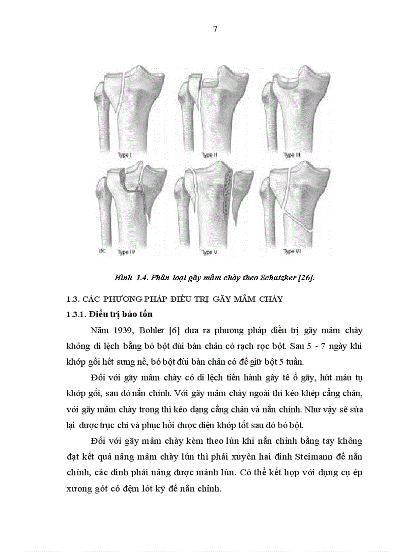 image for page Nghiên cứu sự thay đổi áp lực khoang và đánh giá kết quả điều trị gãy kín mâm chày bằng kết xương nẹp vít