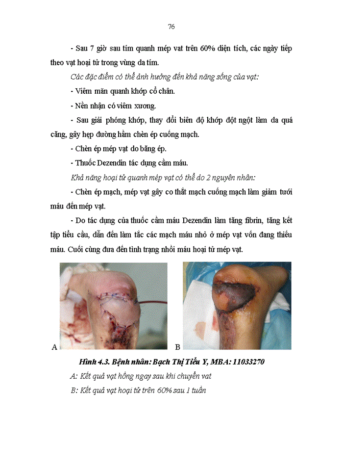 image for page Khảo sát thực trạng sử dụng thuốc điều trị đái tháo đường typ 2 tại khoa nội tiết và đái tháo đường bệnh viện bạch mai