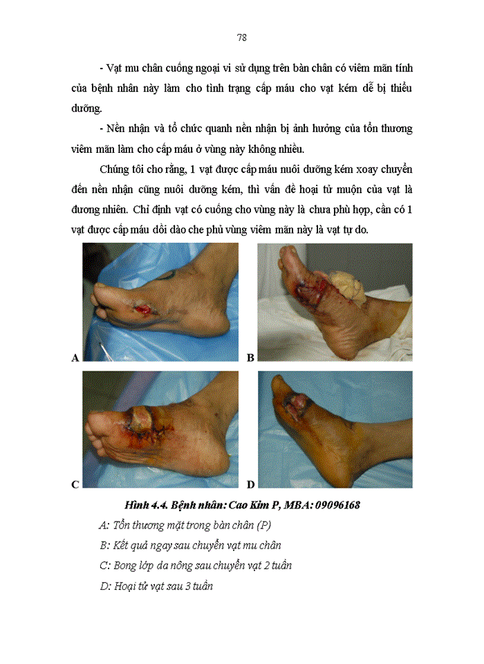 image for page Khảo sát thực trạng sử dụng thuốc điều trị đái tháo đường typ 2 tại khoa nội tiết và đái tháo đường bệnh viện bạch mai